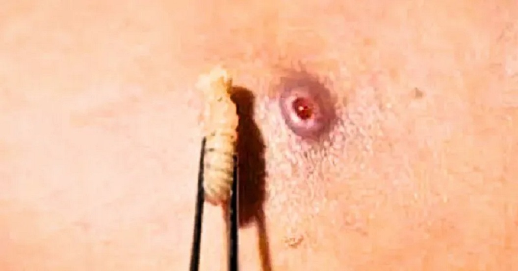 Belice confirma el primer caso de gusano barrenador en humanos