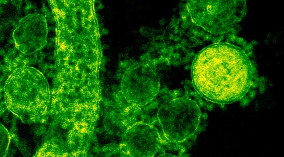 Suman ocho muertos en EE.UU. por bacteria carnívora