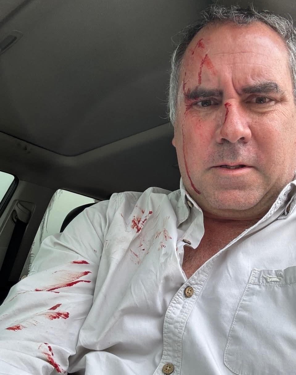 Precandidato presidencial de Perú Rafael Belaúnde sufre ataque a balazos